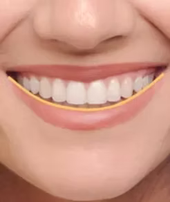 잘 맞는 미소의 대칭
