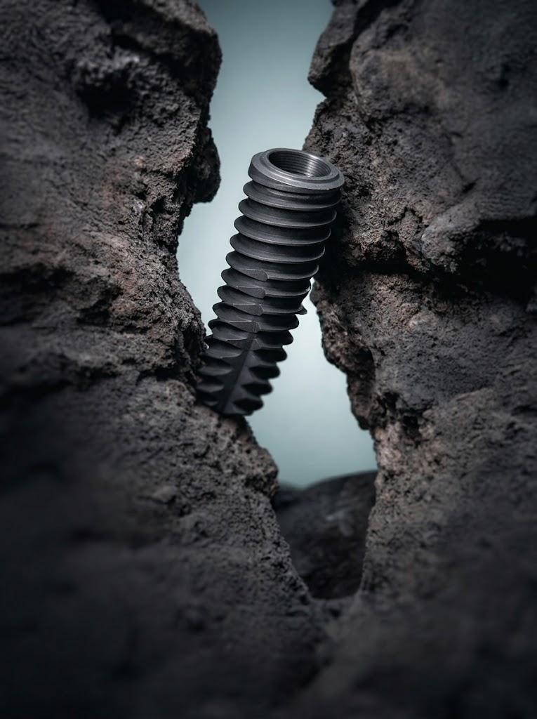 Implant