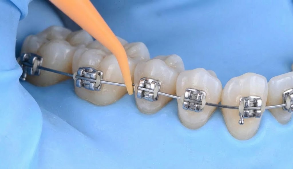 Orthodontics